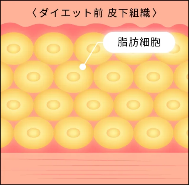 ダイエットなどによる痩せ方