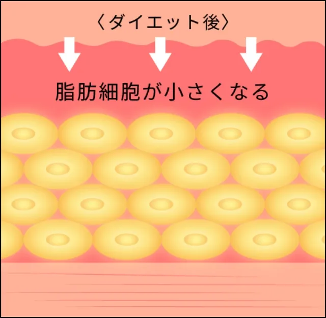 ダイエットなどによる痩せ方