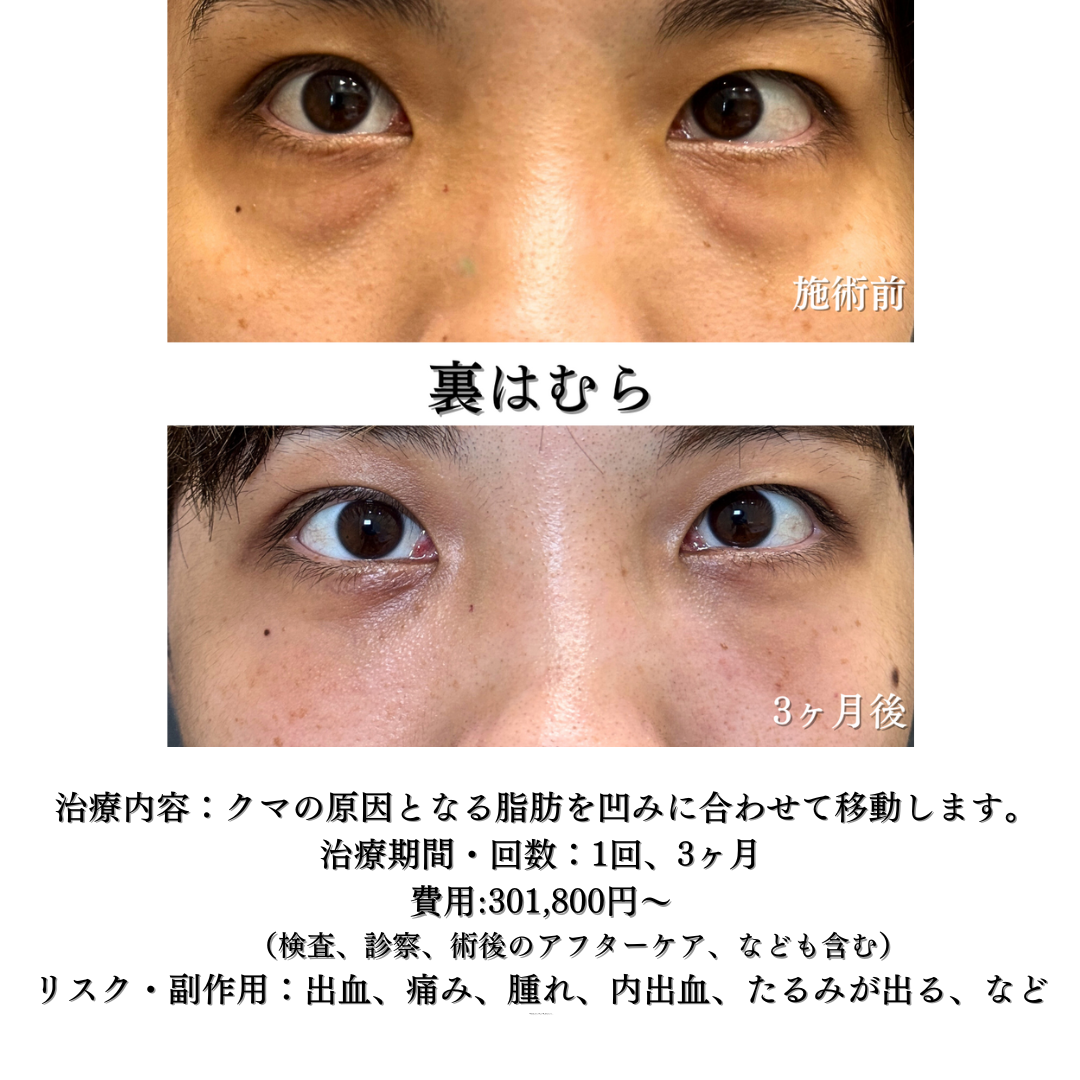 裏はむらの症例です。