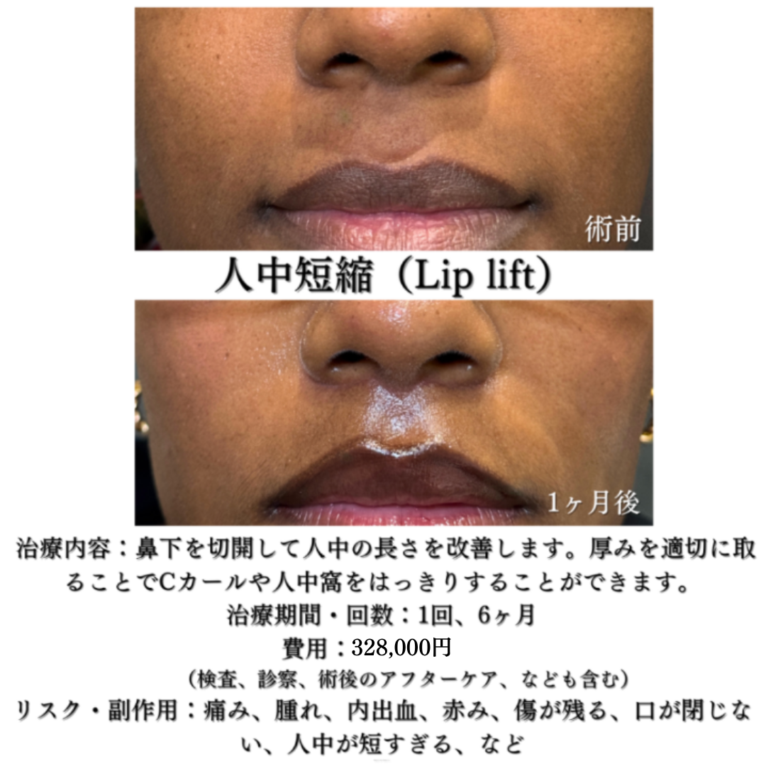 人中短縮1ヶ月です💁‍♀️