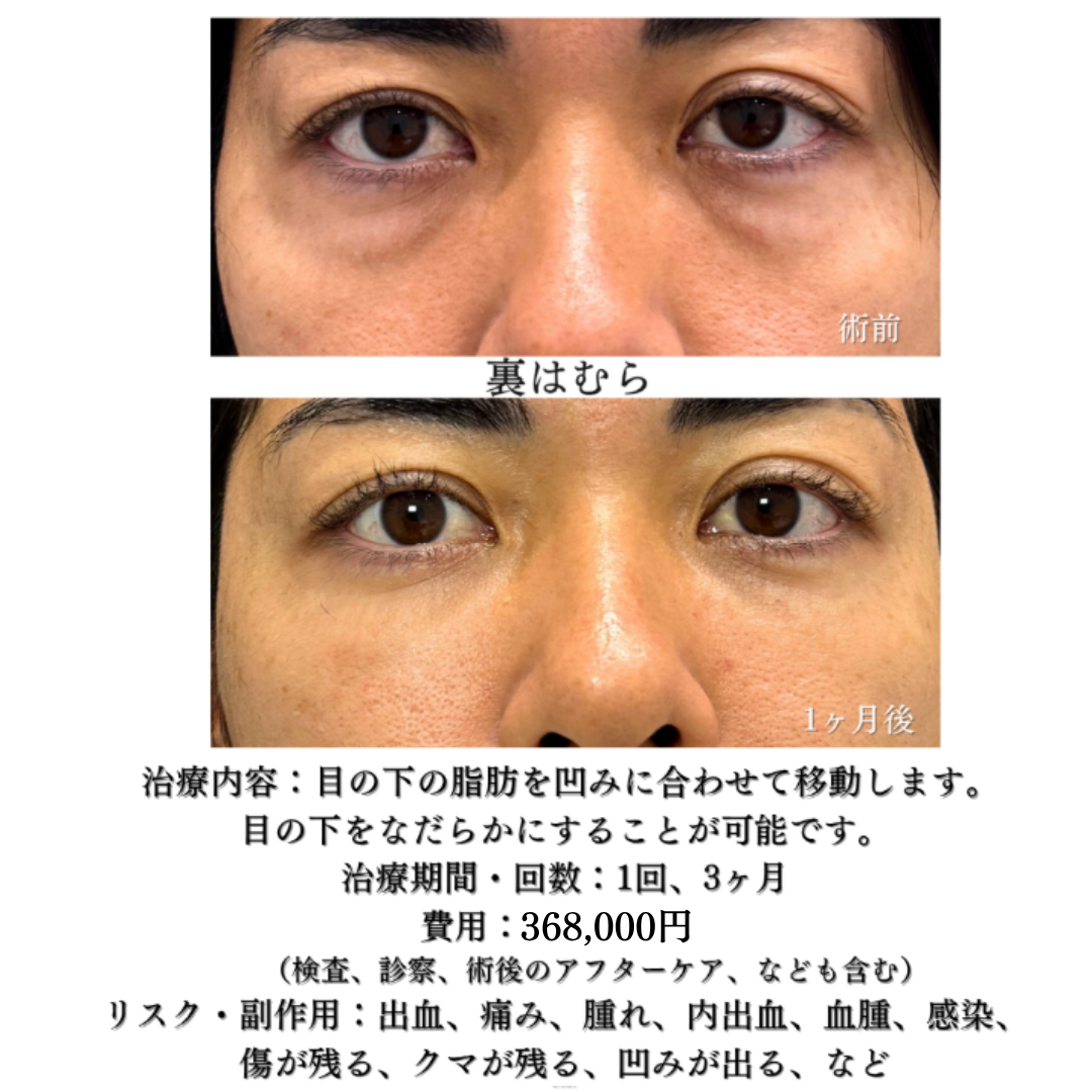 裏はむらの症例です💡