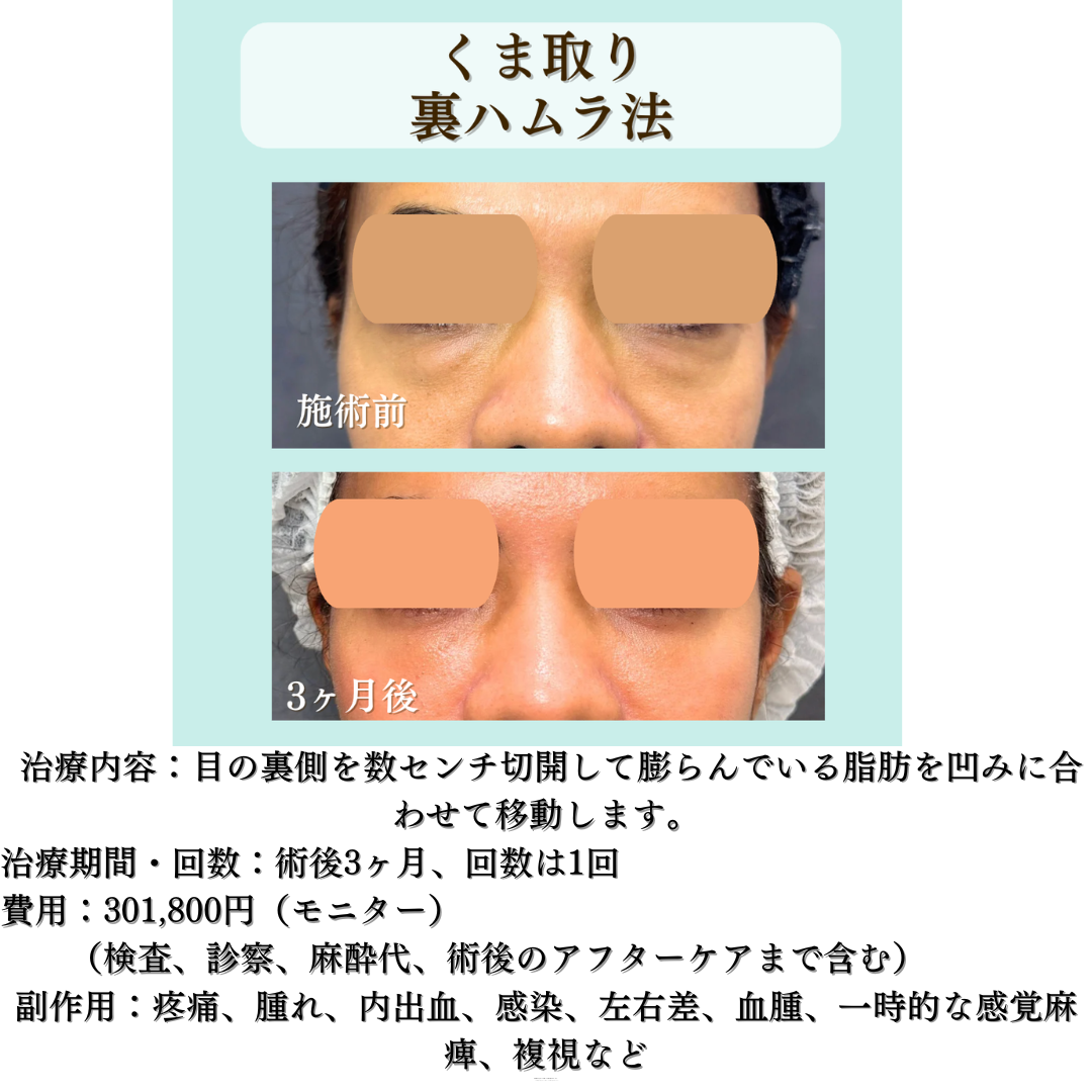 裏はむらの症例です✨