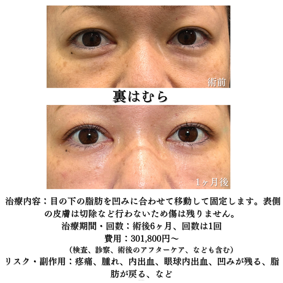 裏はむらの症例です✨