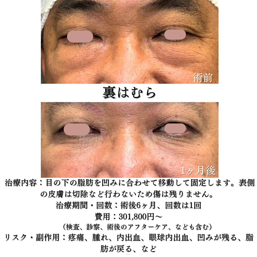 裏はむら1ヶ月の症例です💁‍♀️
