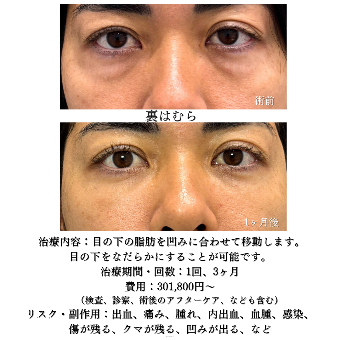 裏はむらの症例です💡