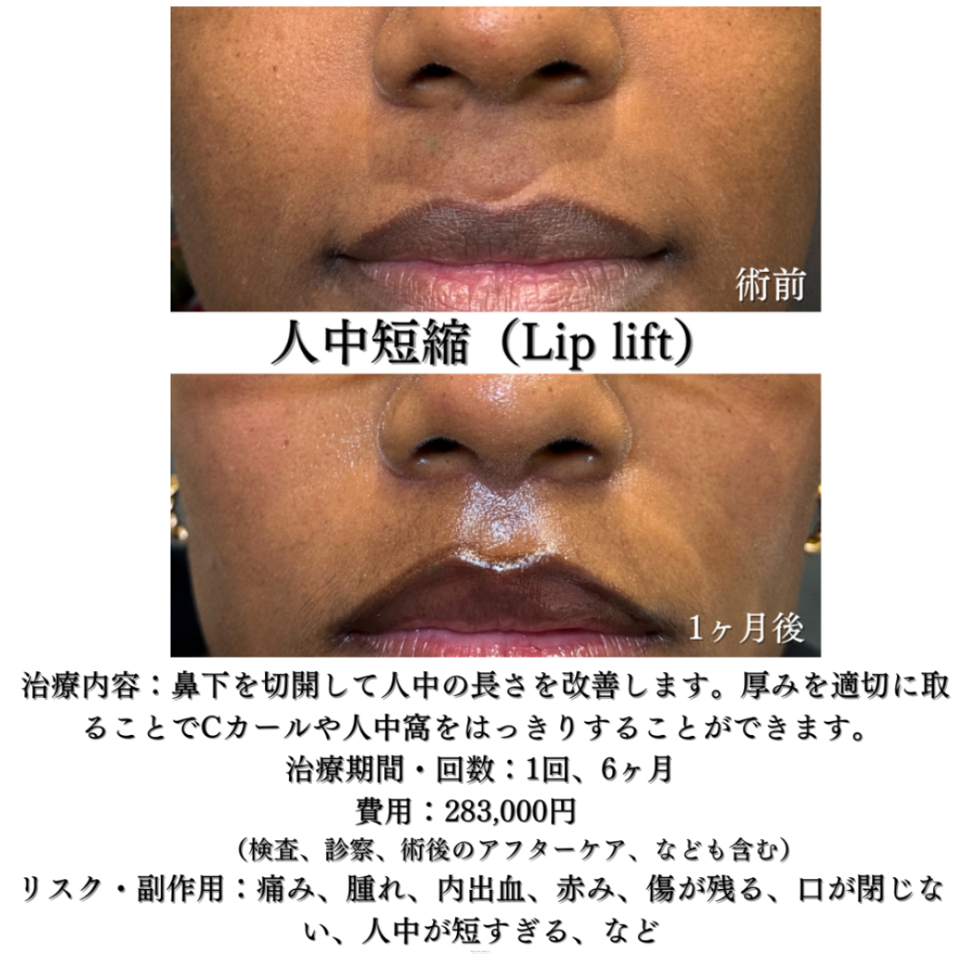 人中短縮1ヶ月です💁‍♀️
