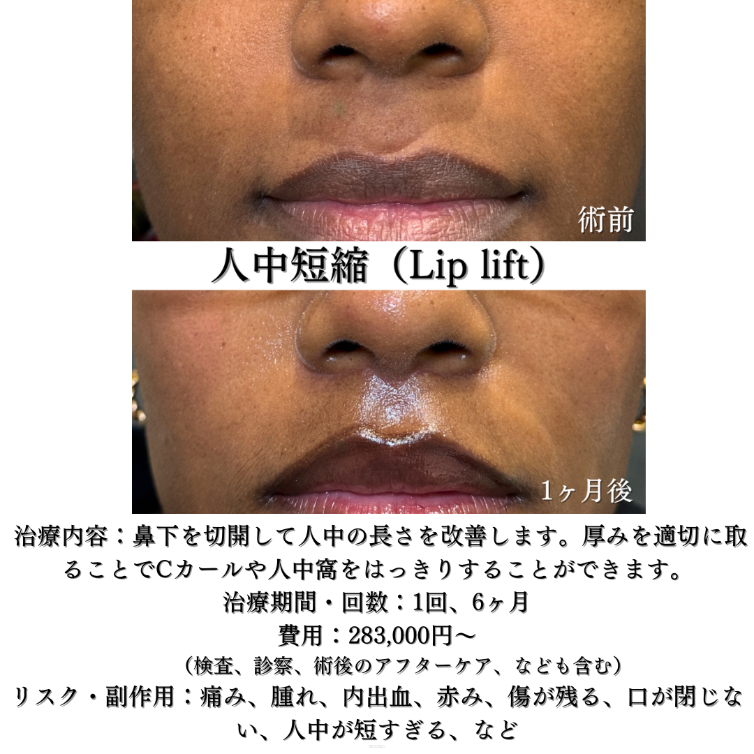 人中短縮1ヶ月です💁‍♀️