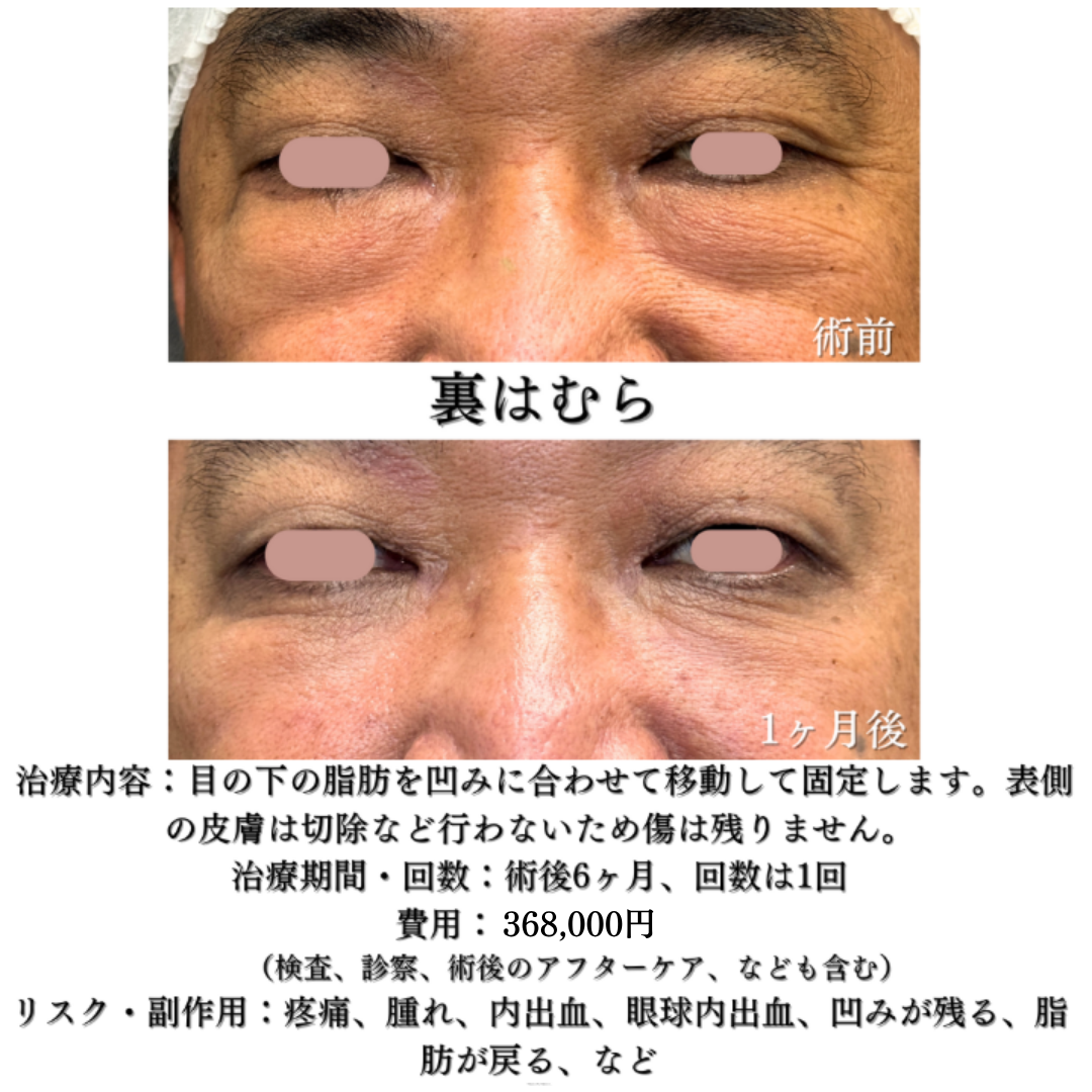 裏はむら1ヶ月の症例です💁‍♀️