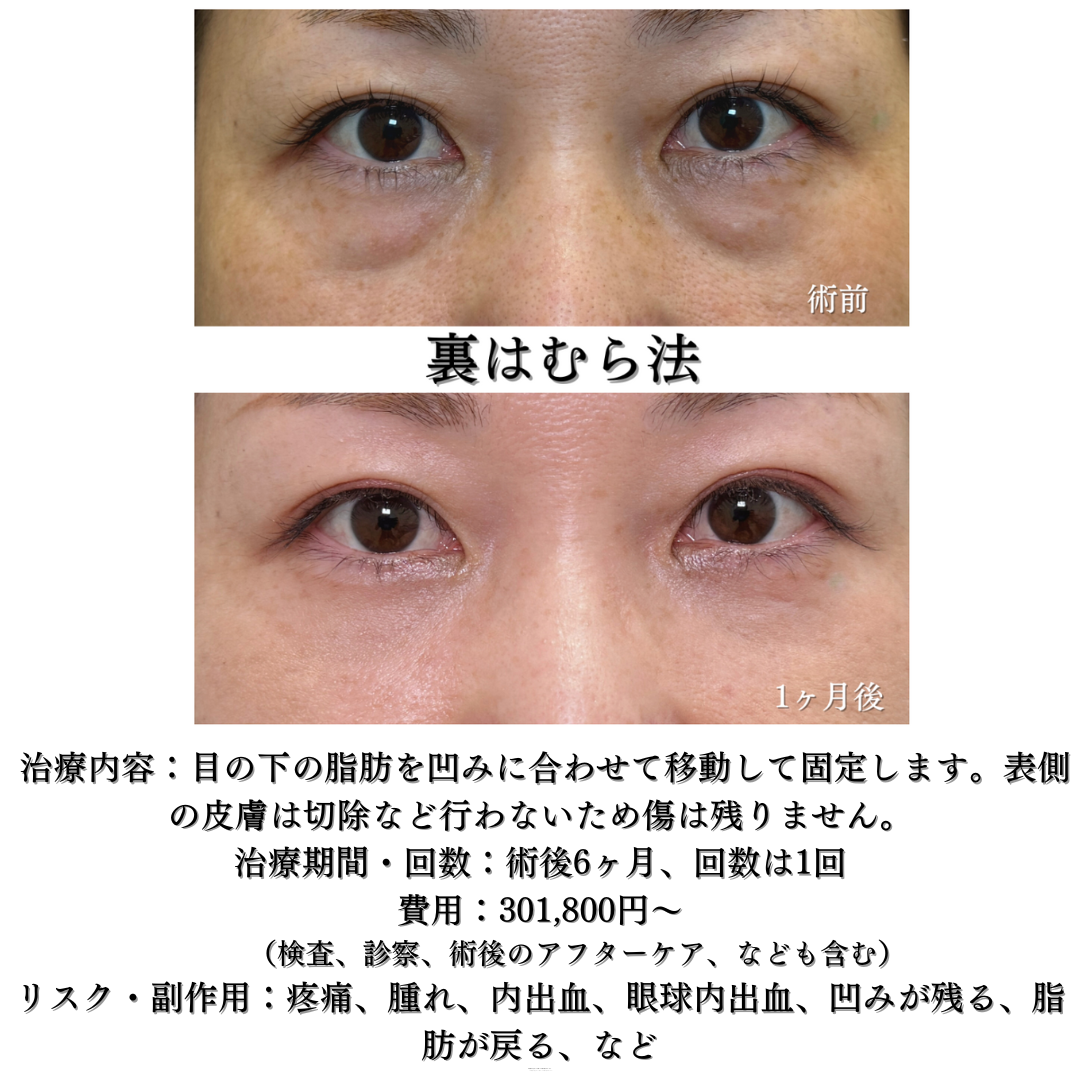 裏はむらの方です✨