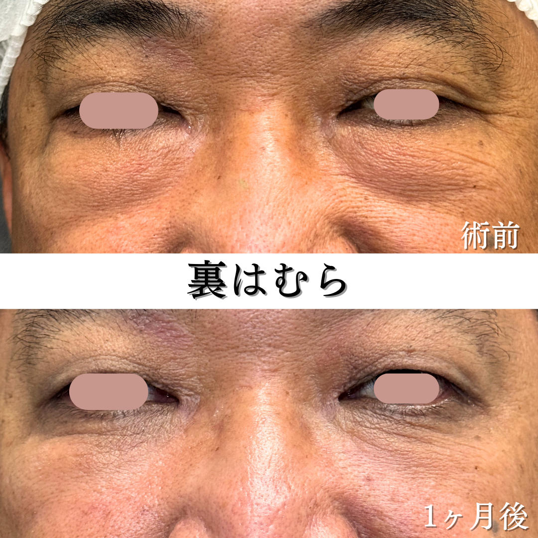 裏はむら1ヶ月の症例です💁‍♀️