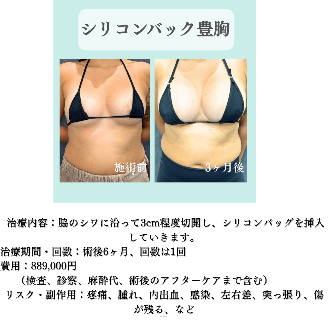 バック豊胸の症例です☺️